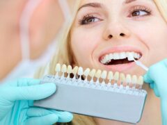 Dental Veneer Dilemmas