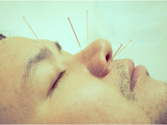 functional medicine doctor Clearwater FL